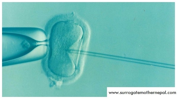 Looking for IVF treatment in Nepal